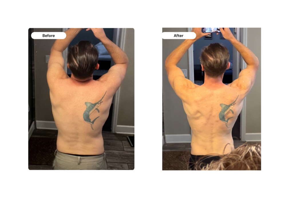 Cass before and after - back